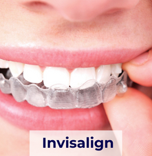 A link to the Invisalign page